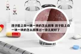 孩子脸上白一块一块的怎么回事 孩子脸上白一块一块的怎么回事过一会儿就好了