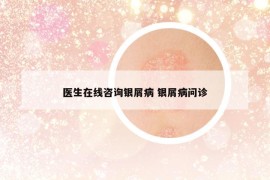 医生在线咨询银屑病 银屑病问诊