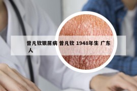 曾凡钦银屑病 曾凡钦 1948年生 广东 人