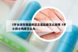 5岁女孩生殖器附近总是起癣怎么回事 5岁小孩小鸡痒怎么办