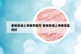 看银屑病上海哪家医院 看银屑病上海哪家医院好