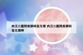内江二医院皮肤科在几楼 内江二医院皮肤科在几楼啊