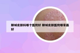 聊城皮肤科哪个医院好 聊城皮肤医院哪家最好