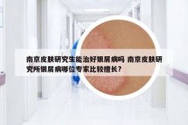 南京皮肤研究生能治好银屑病吗 南京皮肤研究所银屑病哪位专家比较擅长?