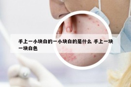 手上一小块白的一小块白的是什么 手上一块一块白色