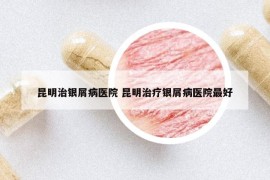 昆明治银屑病医院 昆明治疗银屑病医院最好
