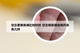 空总看银屑病比较好的 空总银屑病自制药膏有几种