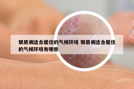 银屑病适合居住的气候环境 银屑病适合居住的气候环境有哪些