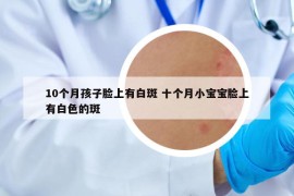 10个月孩子脸上有白斑 十个月小宝宝脸上有白色的斑