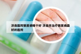 济南医院银屑病哪个好 济南市治疗银屑病最好的医院
