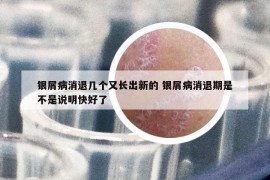 银屑病消退几个又长出新的 银屑病消退期是不是说明快好了