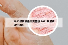 2023银屑病指南完整版 2021银屑病研究进展