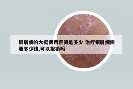 银屑病的大概费用区间是多少 治疗银屑病需要多少钱,可以报销吗