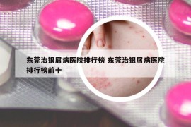 东莞治银屑病医院排行榜 东莞治银屑病医院排行榜前十