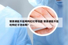 银屑病能不能喝枸杞红枣桂圆 银屑病能不能吃枸杞子泡水喝?