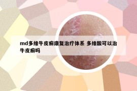 md多维牛皮癣康复治疗体系 多维酸可以治牛皮癣吗