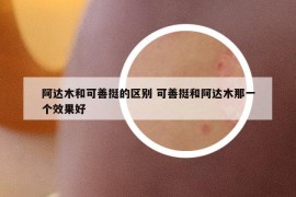 阿达木和可善挺的区别 可善挺和阿达木那一个效果好