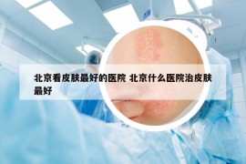 北京看皮肤最好的医院 北京什么医院治皮肤最好