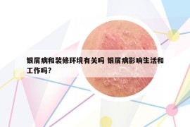 银屑病和装修环境有关吗 银屑病影响生活和工作吗?
