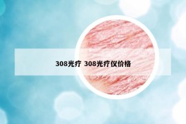 308光疗 308光疗仪价格