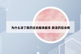 为什么涂了藓药还会越来越多 藓涂药后会痒