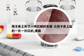 孩子身上长了一块红癣的东西 小孩子身上起的一片一片红的,像癣