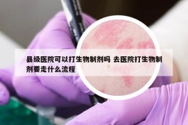 县级医院可以打生物制剂吗 去医院打生物制剂要走什么流程