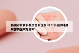 扬州市皮肤科最厉害的医院 扬州市皮肤科最厉害的医院是哪家