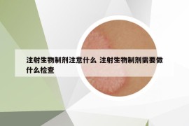 注射生物制剂注意什么 注射生物制剂需要做什么检查