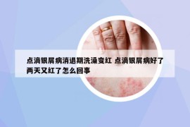 点滴银屑病消退期洗澡变红 点滴银屑病好了两天又红了怎么回事