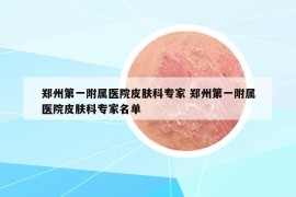 郑州第一附属医院皮肤科专家 郑州第一附属医院皮肤科专家名单