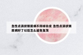 急性点滴状银屑病不停掉白皮 急性点滴状银屑病好了以后怎么避免复发