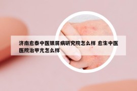 济南愈泰中医银屑病研究院怎么样 愈生中医医院治甲亢怎么样