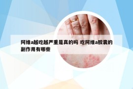 阿维a越吃越严重是真的吗 吃阿维a胶囊的副作用有哪些