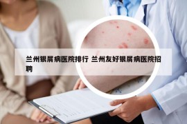兰州银屑病医院排行 兰州友好银屑病医院招聘