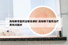 南阳那家医院治银肖病好 南阳哪个医院治疗男性问题好