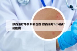 陕西治疗牛皮癣的医院 陕西治疗hpv最好的医院