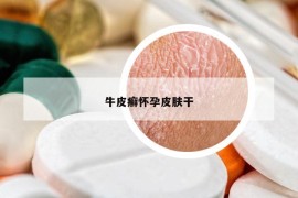 牛皮癣怀孕皮肤干