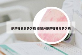 酮康唑乳膏多少钱 萘替芬酮康唑乳膏多少钱