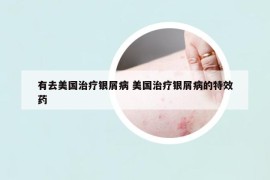 有去美国治疗银屑病 美国治疗银屑病的特效药