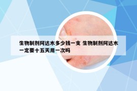 生物制剂阿达木多少钱一支 生物制剂阿达木一定要十五天用一次吗