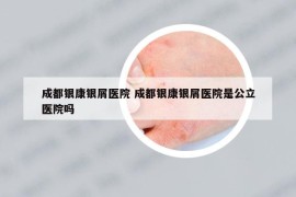 成都银康银屑医院 成都银康银屑医院是公立医院吗