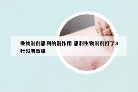 生物制剂恩利的副作用 恩利生物制剂打了8针没有效果