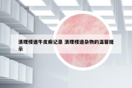 清理楼道牛皮癣记录 清理楼道杂物的温馨提示