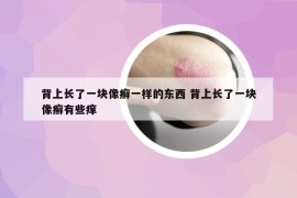 背上长了一块像癣一样的东西 背上长了一块像癣有些痒