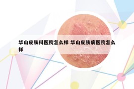 华山皮肤科医院怎么样 华山皮肤病医院怎么样