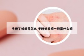 手腕了长癣是怎么 手腕处长癣一般是什么癣