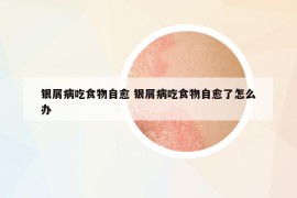 银屑病吃食物自愈 银屑病吃食物自愈了怎么办