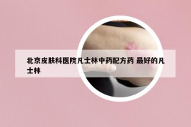 北京皮肤科医院凡士林中药配方药 最好的凡士林