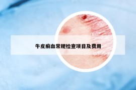 牛皮癣血常规检查项目及费用